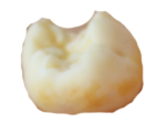 Dente